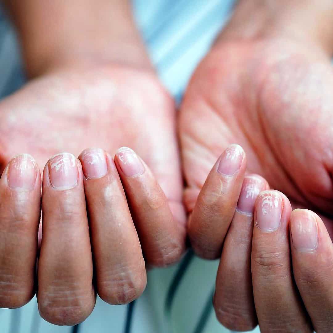 Blue finger nails hi-res stock photography and images - Alamy