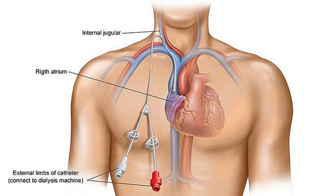 Kırşehir'de Hastaların Dışarı Gitmesine Gerek Yok Dendi Duyuruldu